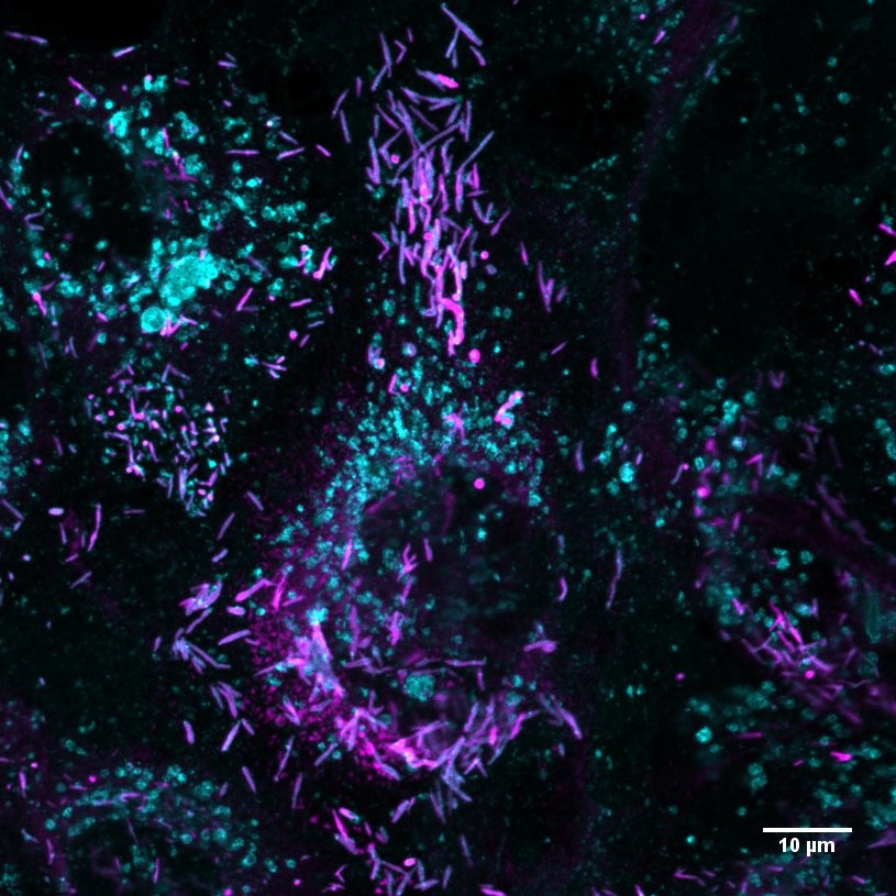 BOECs, blood outgrowth endothelial cells